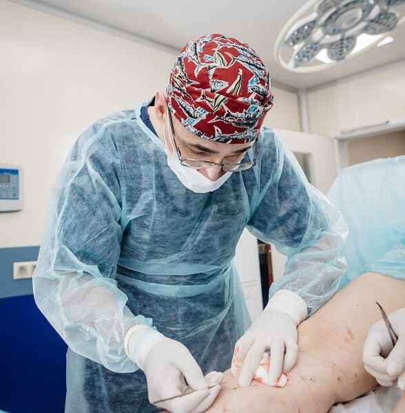 traitement chirurgical des varices